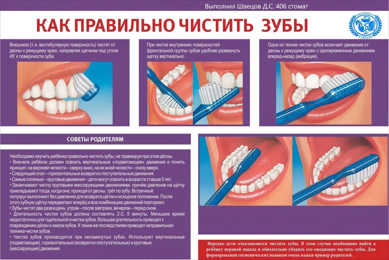 Как правильно чистить зубы. Памятка чистки зубов. Стенд стоматология. Памятка о правильной чистке зубов. Чистить значение