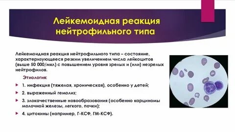 Типы лейкемоидных реакций