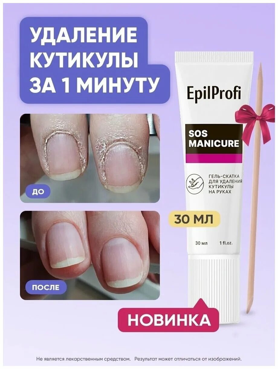 Гель скатка для удаления кутикулы epilprofi. Epilprofi / гель-скатка для удаления кутикулы на руках. SOS Manicure гель скатка.