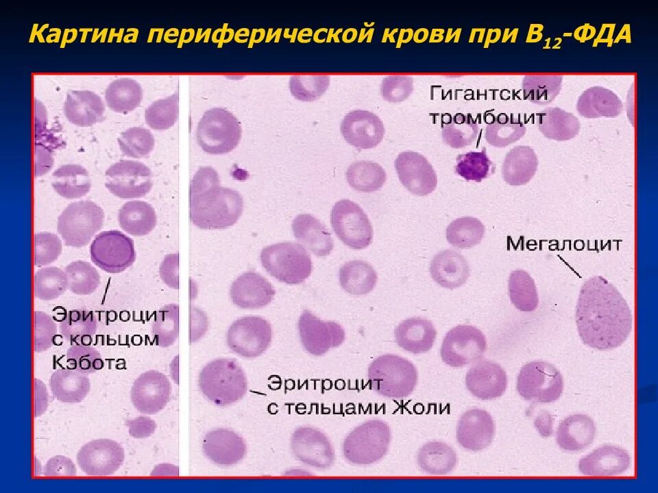 Фолиевая в эритроцитах