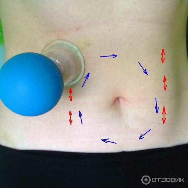 Правильный вакуумный массаж банками. Вакуумно баночный массаж живота. Массаж живота вакуумной банкой.