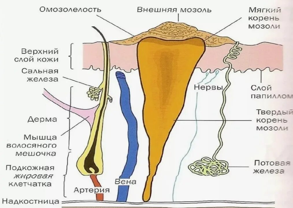 Корешочек. Стержневая корневая мозоль. Стержневая мозоль на стопе.