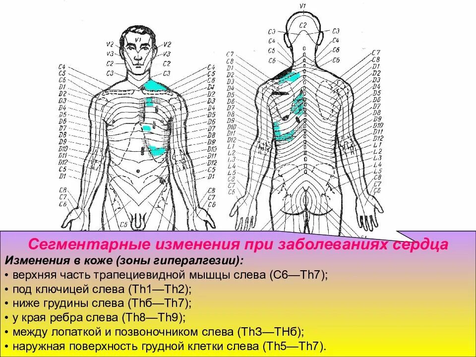 Зона поясницы. Рефлекторные зоны Захарьина-Геда схема. Схемы для рефлекторно-сегментарного массажа. Рефлекторно-сегментарный массаж позвоночника. Зоны Захарьина Геда спинной мозг.