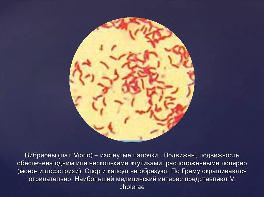 Известно что холерный вибрион вид подвижных. Грамотрицательные микрококки. Грамотрицательные вибрионы. Грамотрицательные подвижные палочки. Грамотрицательные палочковидные бактерии.