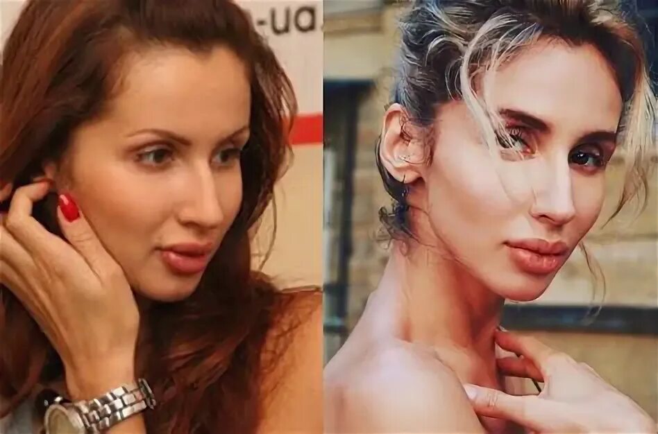 Фото светланы лободы до и после Лобода до пластики и после фото