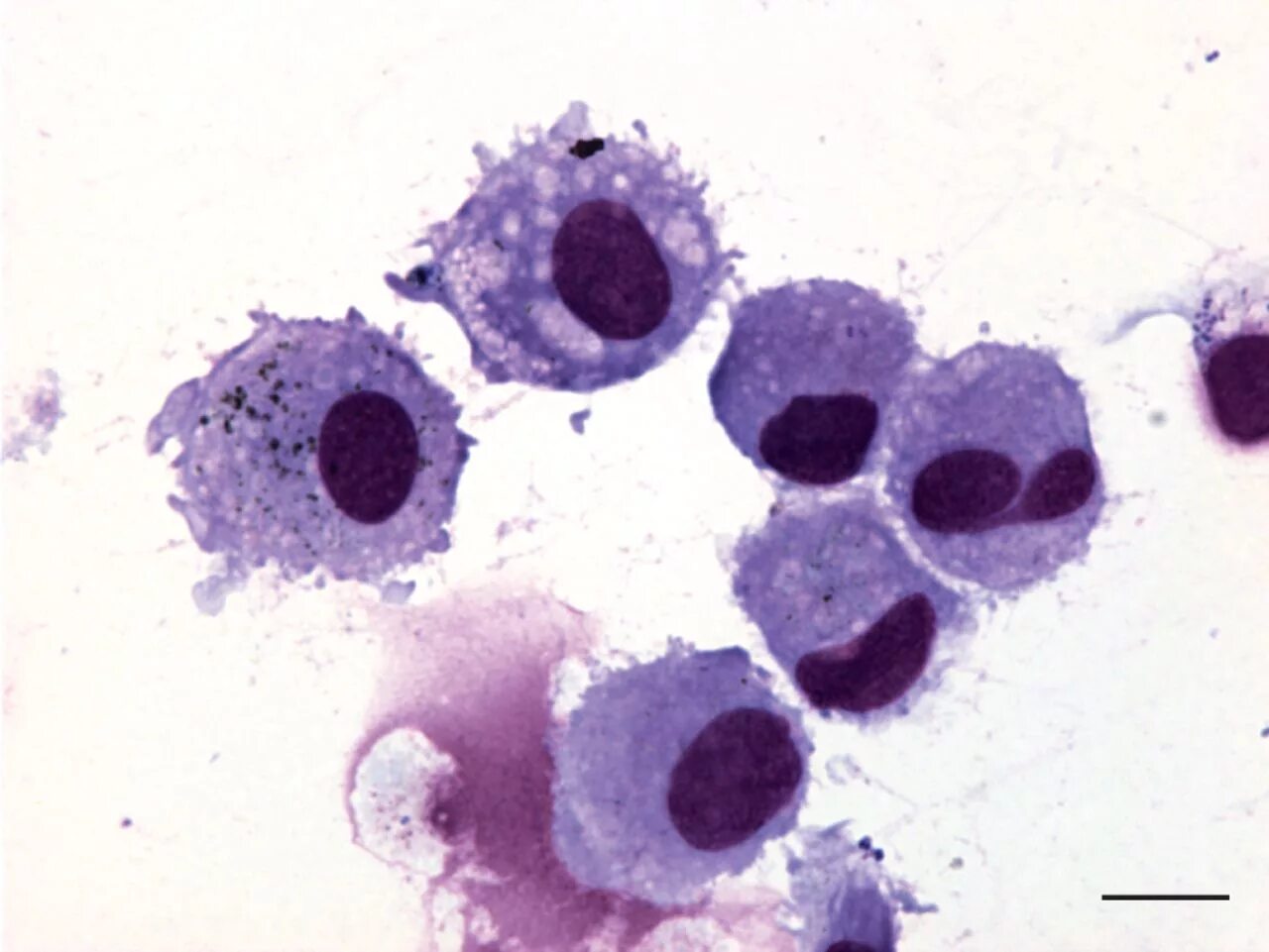 Макрофаги препарат. Макрофаги: моноциты гистиоциты. Лейкоциты, гистиоциты, макрофаги. Гистиоциты фагоциты. Макрофаги гистология.