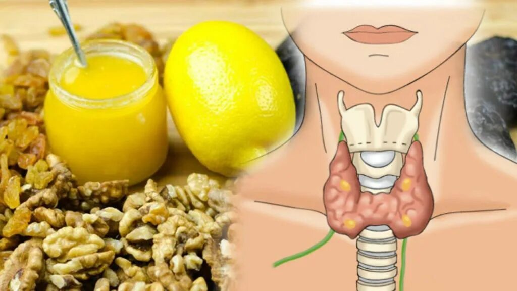 продукты содержащие йод для щитовидной железы детям таблица. щитовидная железа вредные продукты. продукты для щитовидной. питание для щитовидки. щитовидная железа вредные продукты.