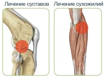 Prp коленного сустава