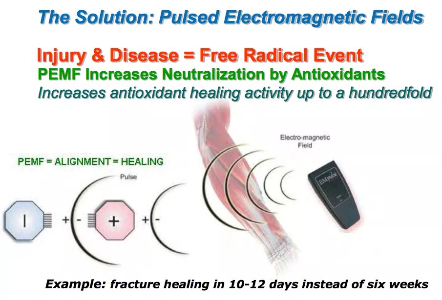 Stereostim. Phys rev d. Magnetic pulse. Electromagnetic pulse. Electromagnetic pulse.