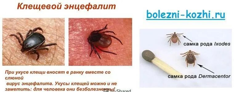 Тюмень энцефалит. Клещи боррелиоз и энцефалит. боррелиоз и клещевой энцефалит. укус энцефалит клещевой энцефалит. симптомы укуса энцефалитного клеща.