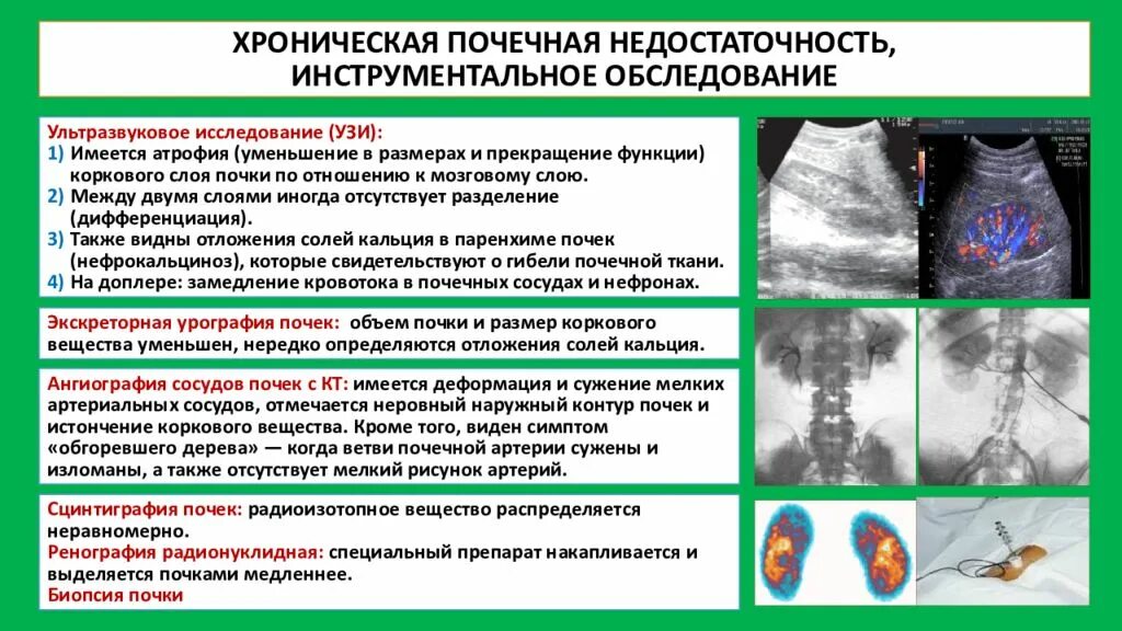 Хроническая почечная недостаточность на УЗИ. Изменения на УЗИ при хронической почечной недостаточности. Хроническая почечная недостаточность на УЗИ почек. Острая почечная недостаточность УЗИ. Хбп диагностика