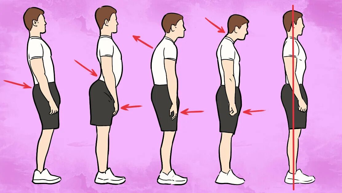 Почему стоя становится плохо. Правильная осанка. Неправильная осанка. Правильная осанка у человека. Правильная и неправильная осанка.