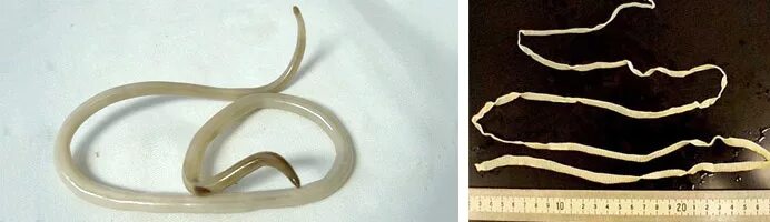 при какой температуре погибают глисты. аскариды ленточные черви. заболевания вызванные гельминтами у человека. гельминты погибают при температуре. паразиты лямблии аскариды.