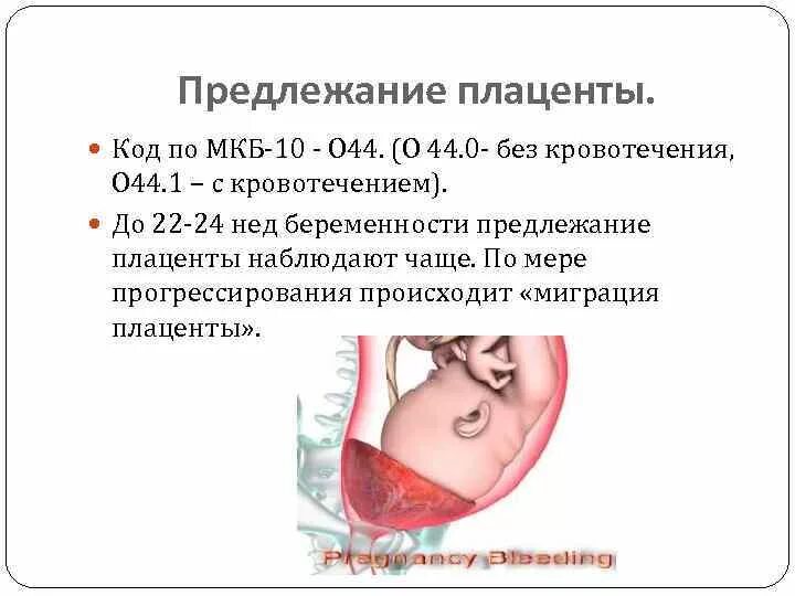 Низкая плацентация при беременности код мкб 10. Предлежание плаценты. Степени предлежания плаценты. Предлежание плаценты мкб.