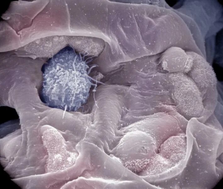 Макрофаги 4. Макрофаги под микроскопом. Макрофаг под электронным микроскопом. Электронный микроскоп снимки. Макрофаг в микроскопе.