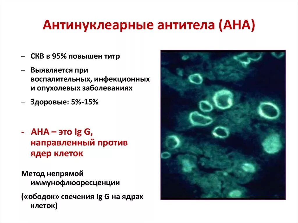Норма показателя антинуклеарных антител. Антинуклеарные антитела (Ana)расшифровка. Антинуклеарные антитела Ana норма. Антинуклеарные антитела при СКВ.