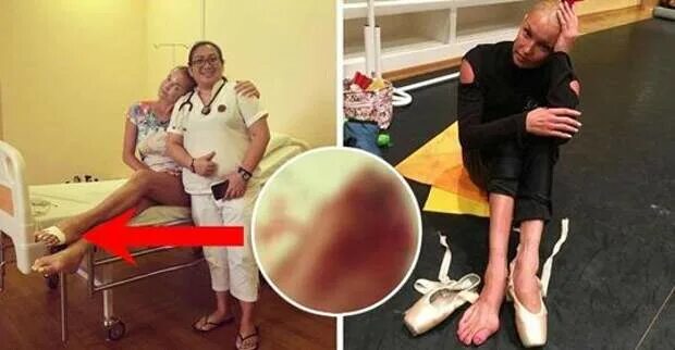 Над волочковой издеваются. Ноги балерины волочковой без пуантов. ноги балерины волочковой.