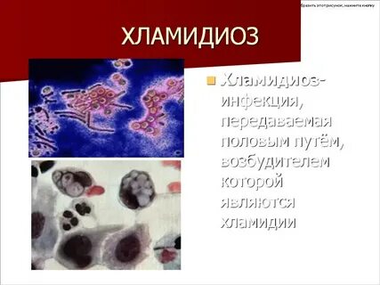 Хламидиоз последствия