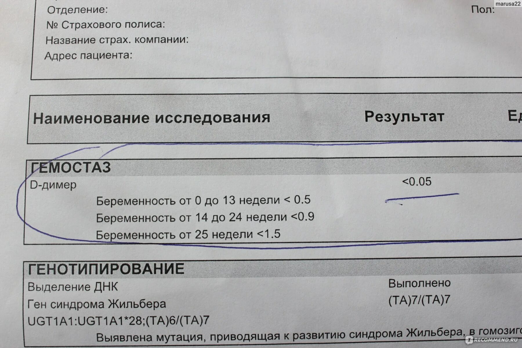 Синдром Жильбера анализ. Анализ крови на синдром Жильбера. Ген синдром Жильбера анализ. Синдром Жильбера Результаты анализов. Д димер хеликс