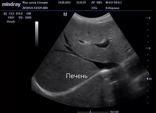 Сделать узи в Выборгском районе