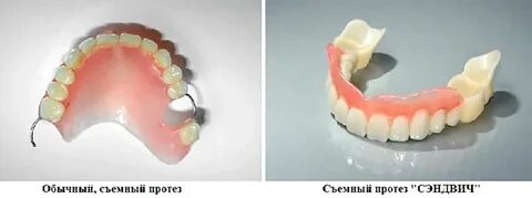 Съемные протезы с небом отзывы
