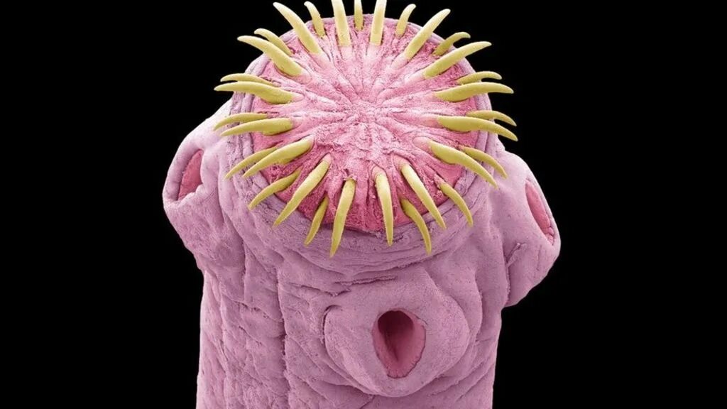 Где у земляного червя голова. Музей паразитологии мегуро мегуро япония. Строение червя дождевого ест ли мозг. Простомиум и перистомиум. Строение кольчатых червей.