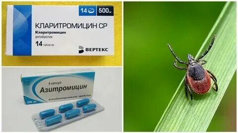 Какие антибиотики пропить при укусе клеща. Какие антибиотики пропить при укусе клеща