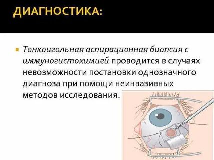 Тонкоигольная аспирационная биопсия