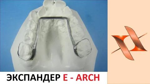 E arch