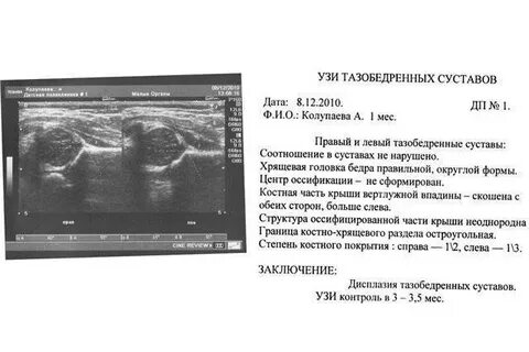 Узи тихонович