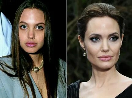 Анджелина джоли какие операции