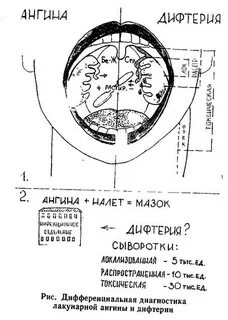 Материал на дифтерию