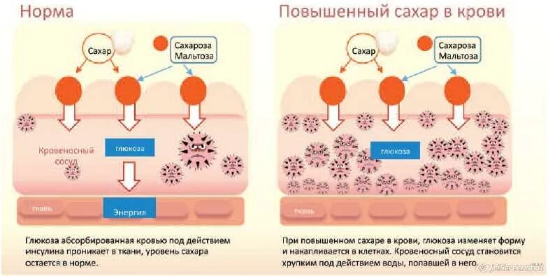 Почему появилась сахара. Сахар в крови. Повышение сахара в крови. Повышен сахар в крови. Повысился сахар в крови.