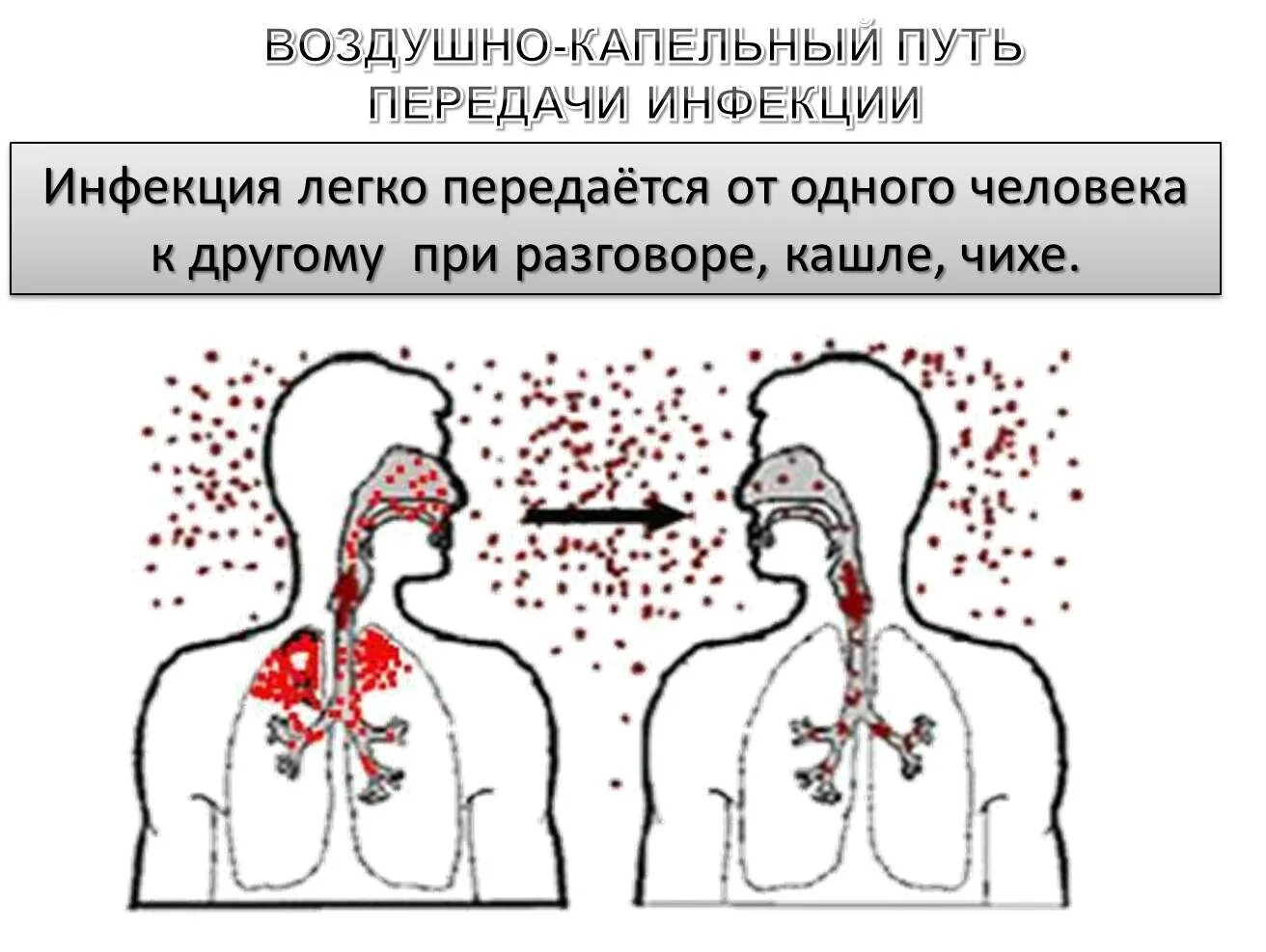 Воздушно капельным или воздушно пылевым. Механизм передачи воздушно-капельных инфекций. Воздушно-капельный путь передачи инфекции аэрозольный. Воздушно капельные инфекции механизм заражения. Механизм передачи инфекции воздушно капельным путем.