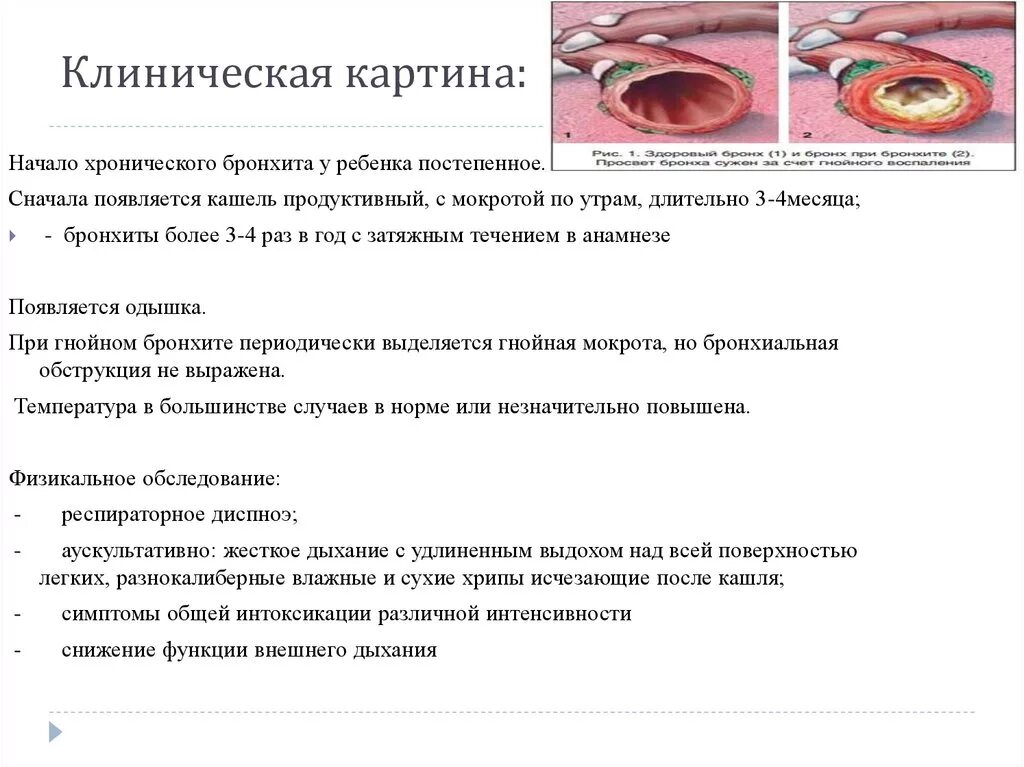 Что делают при бронхите. Обструкционный бронхит симптомы. Острый обструктивный Гнойный бронхит. Острый обструктивный бронхит мокрота. Острый хронический бронхит клинические симптомы.