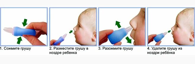 Можно ли отсасывать сопли. Доставать сопли из носа новорожденного. Прочистить ребенку нос новорожденному. Откачивание соплей у грудничка. Правильно отсасывать сопли у грудничка.