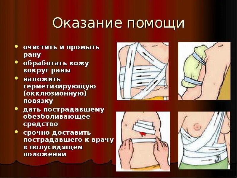 Техника наложения окклюзионной