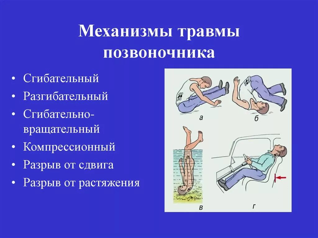 Повреждения позвоночника переломы. Сгибательный механизм перелома позвоночника. Сгибательный механизм травмы позвоночника. Повреждение позвоночника механизм повреждения. Переломы позвоночника классификация механизм травмы.