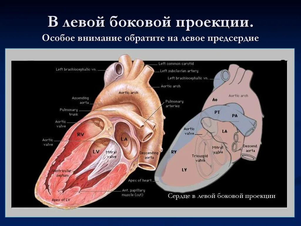 Левое предсердие. Левое предсердие сердца. Лучевая анатомия сердца. Левое предсердие сердца анатомия. Увеличено правое предсердие