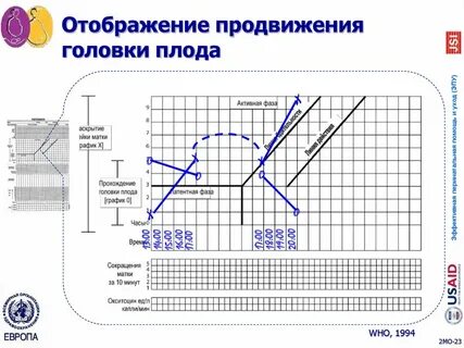 Партограмма