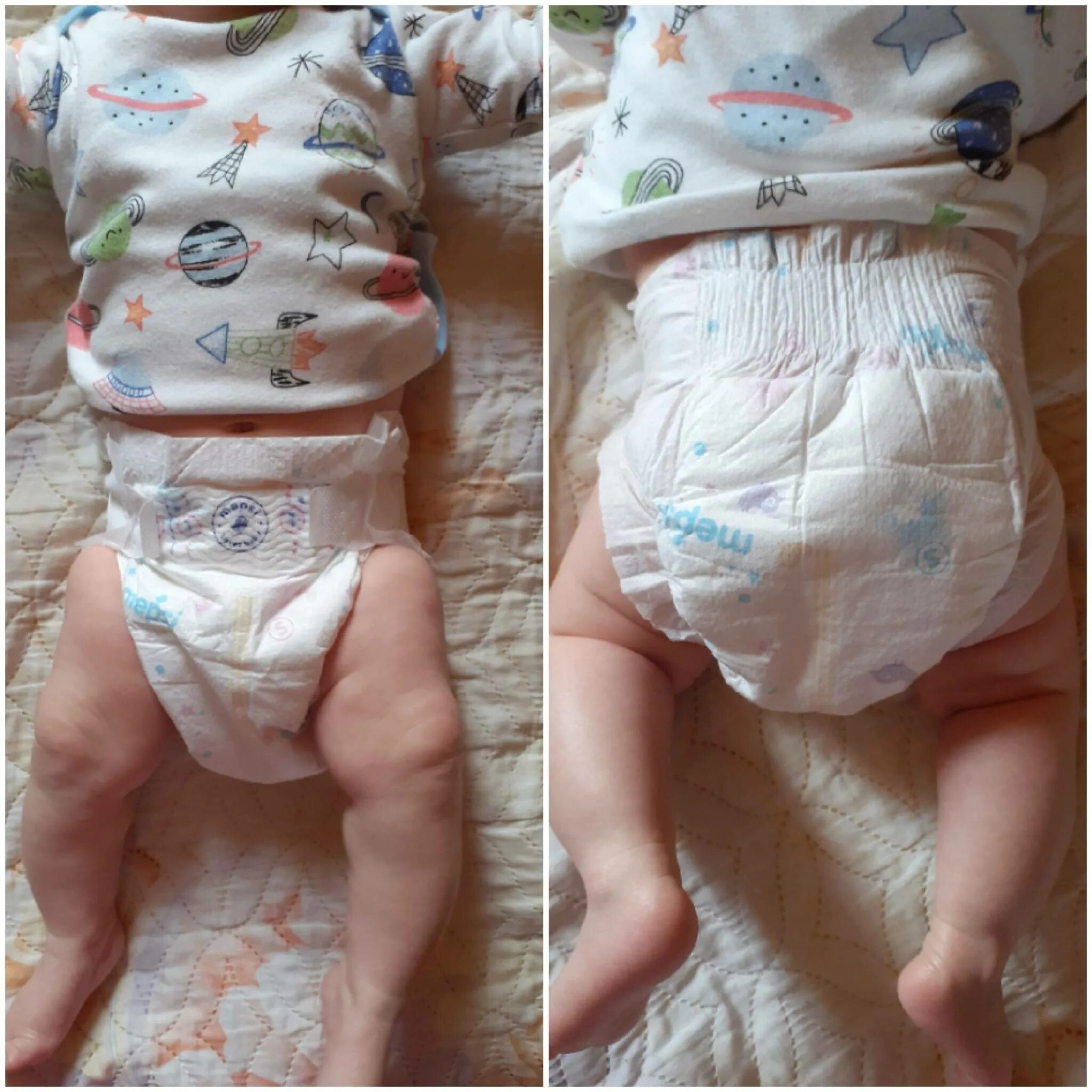 Ребенку меняют подгузник. Одевание памперса младенцам. Подгузники для новорожденных.