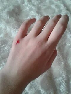 Девушке ломают руку