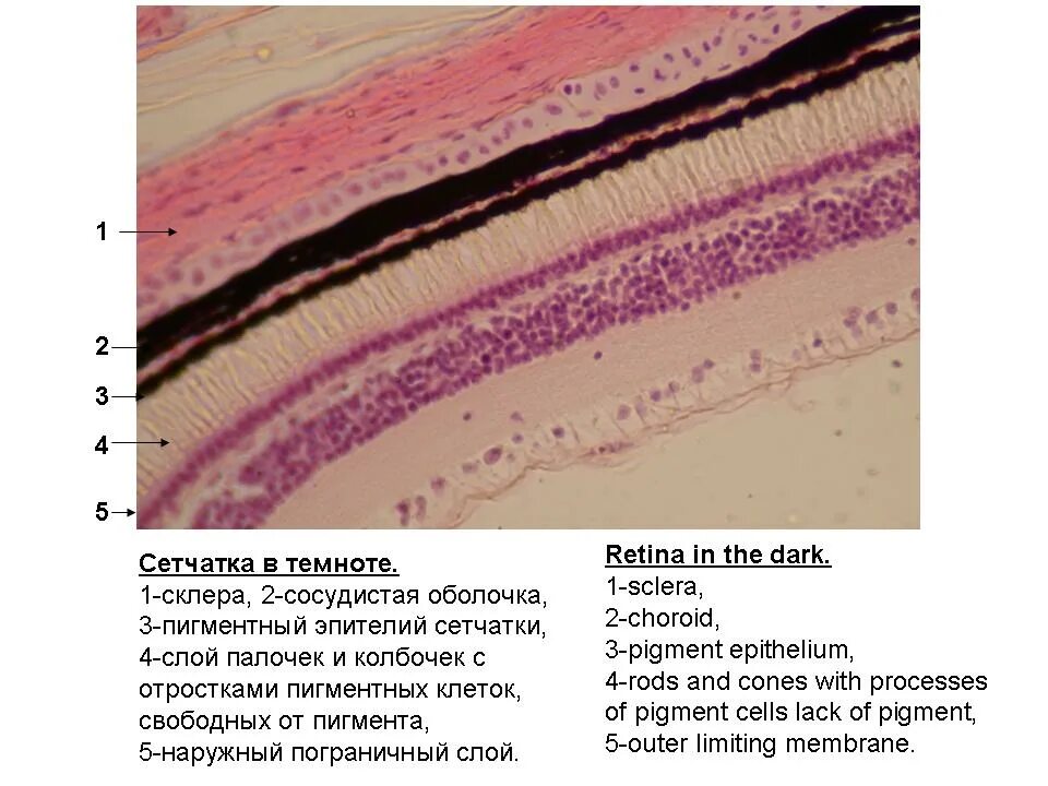 Эпителий роговицы гистология. Сетчатка гистология препарат. Задняя стенка сетчатки глаза гистология. Сетчатка глаза гистология препарат. Гистология черт возьми фанфик