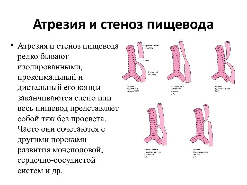 Пищевод у новорожденного