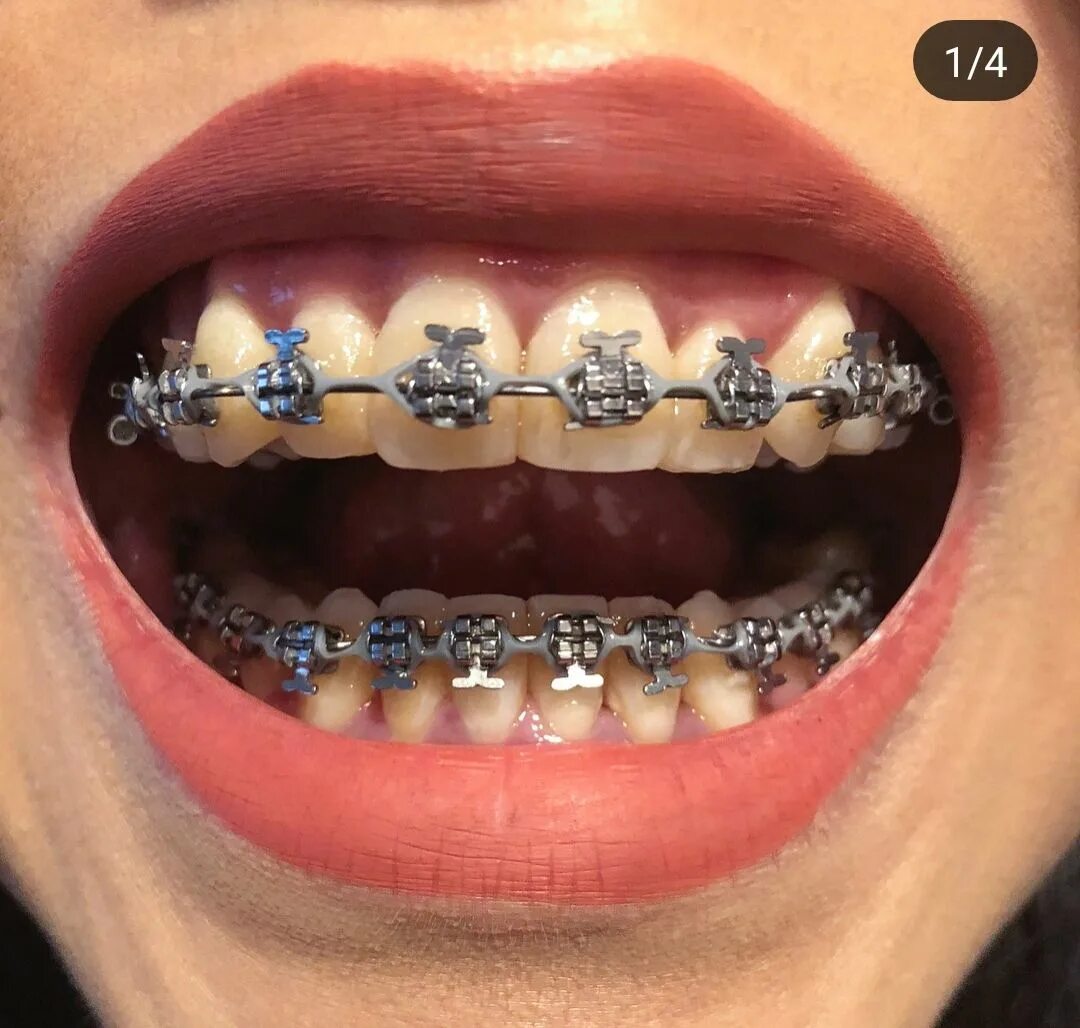 Brackets 2025