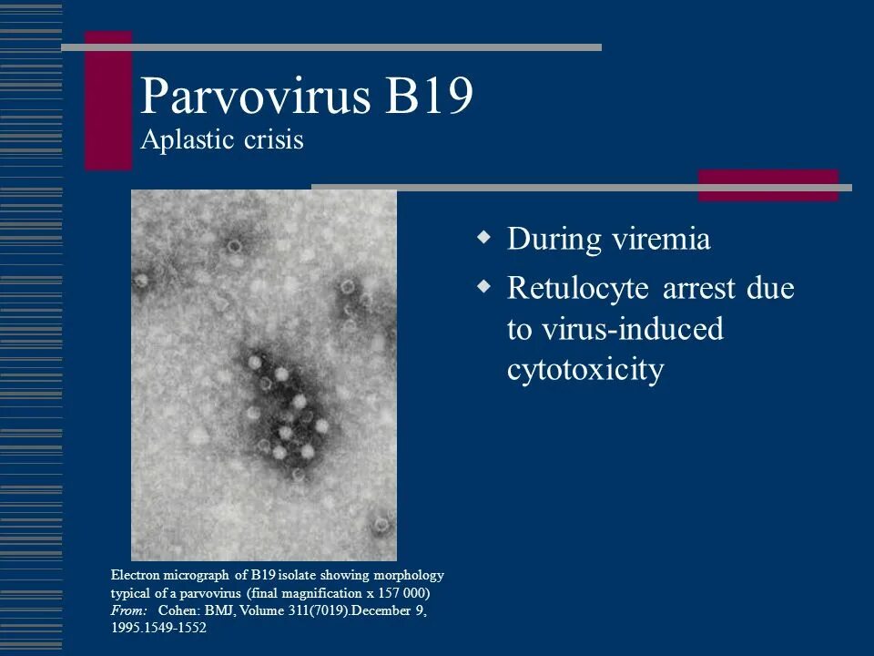 Парвовирус у детей лечение. Парвовирус b19 строение. Parvoviridae (парвовирусы). Вирус парвовирус.