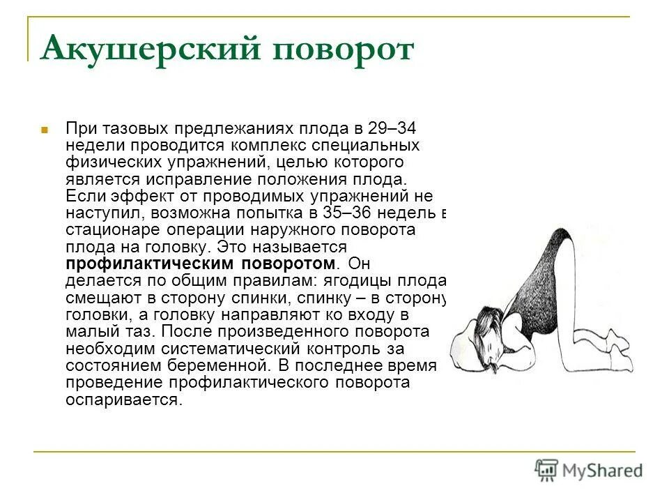 Позы для переворота ребенка. Упражнения при тазовом предлежании. Упражнения перевернуть ребенка. Гимнастика при тазовом предлежании плода. Упражнения для беременных при тазовом предлежании ребёнка.