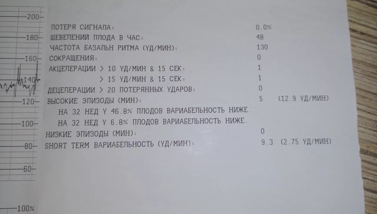 Норма КТГ В 32 недели беременности. Расшифровка КТГ на 32 неделе плода норма. КТГ плода на 32 неделе беременности. КТГ при беременности норма 32 недели норма. Нормы шевелений по неделям