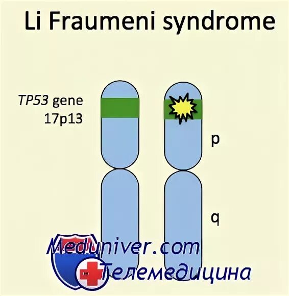 Tp53 ген. Мутация в гене тр53. Синдром ли-Фраумени ген. Синдром ли фраумени