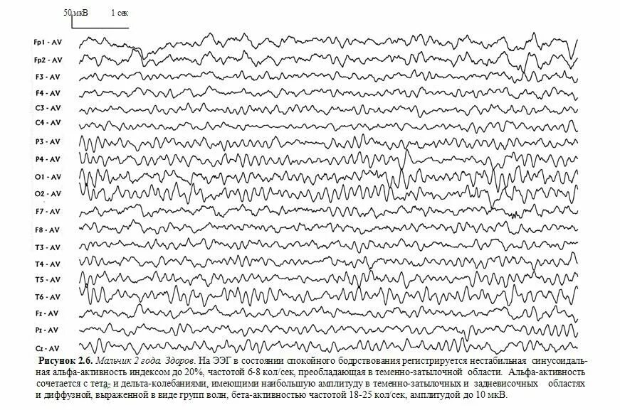 Ээг 9. ЭЭГ нормальные показатели у ребенка 2 года. Альфа ритм на ЭЭГ У детей норма и нарушения. Норма ЭЭГ У ребенка 4 лет норма. Энцефалограмма головного мозга норма у взрослого.